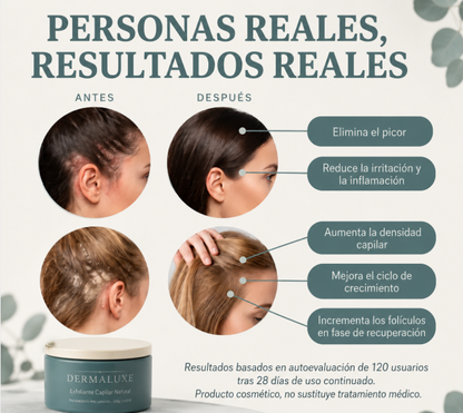 Dermaluxe Scalp Renew™ - Tu cuero cabelludo merece el mismo cuidado que tu piel.