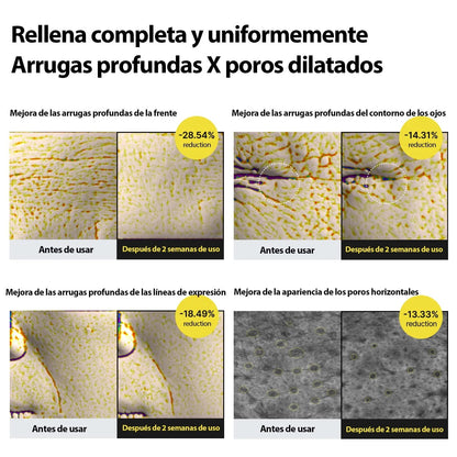 Dermabond Shot™ — Reafirma tu piel y difumina las líneas de expresión